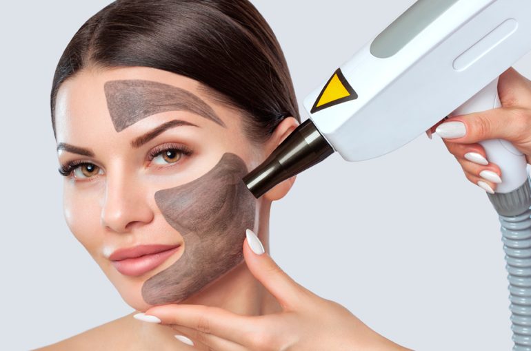 hollywood peel mascarilal de carbon, rejuvenecimineto facial con laser